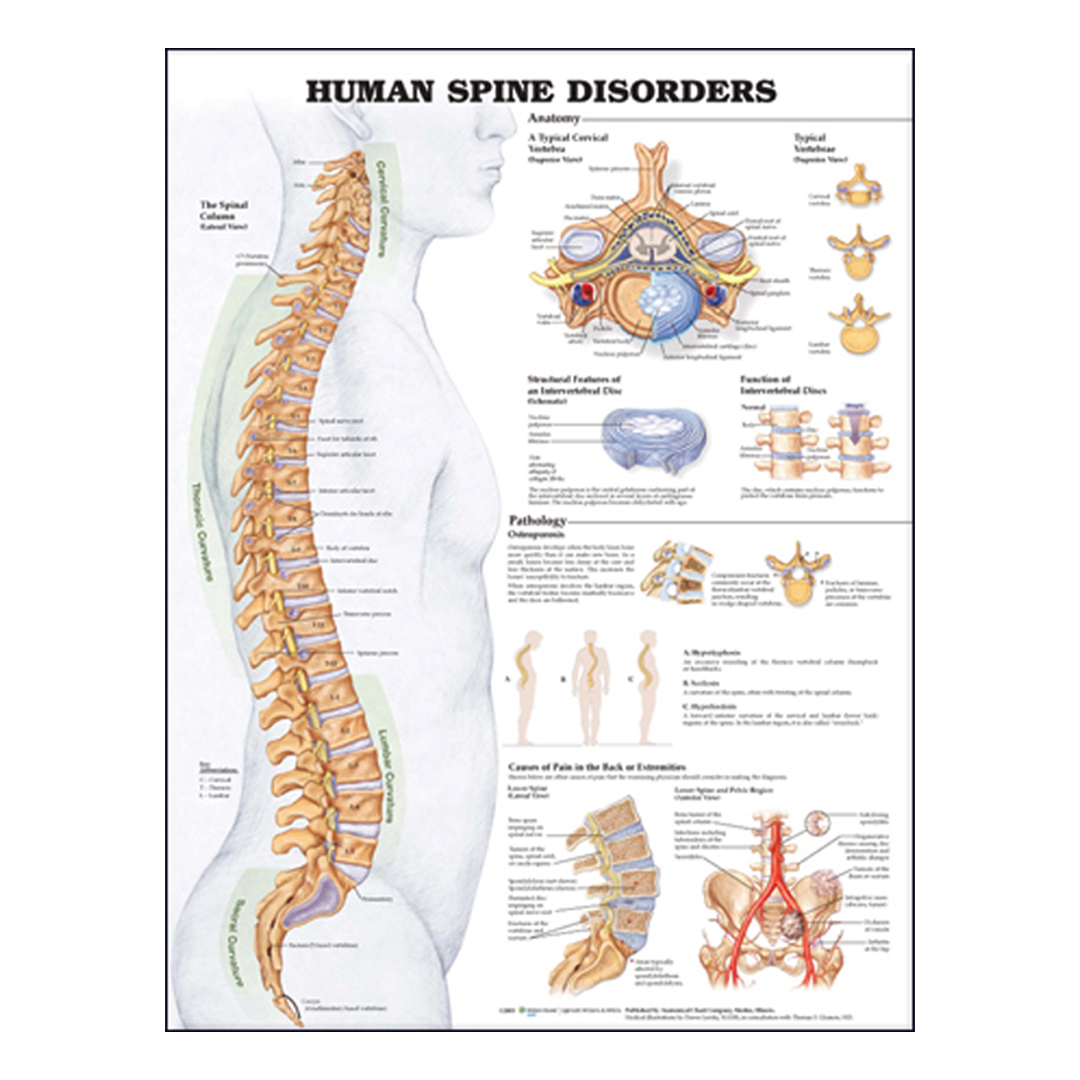 Back Abnormalities Human Spine Disorders Anatomical Chart - Victor Sports