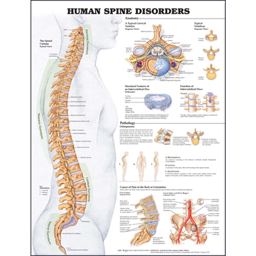 Human Spine Disorders Anatomical Chart