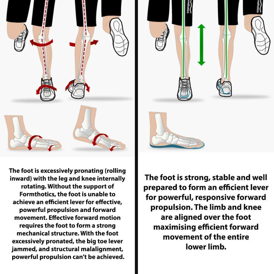 thumbnail image 2 of Formthotics Run Dual Full Length Orthotics – Custom Moldable Insoles For Comfort & Pain Relief (Free Shipping AU) 2 of 6